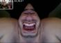 Live Geburt