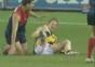 Rugby Spieler bricht sich das Bein