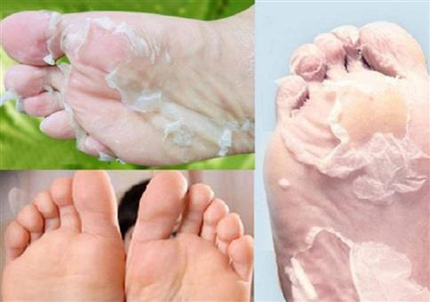 Richtig lecker: Schuppende Füße