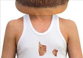 Ich geh zum Fasching als Cheeseburger!