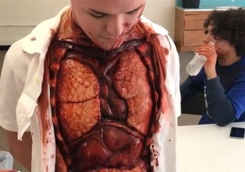 Organschau: Er hat die komplette Forderseite offen