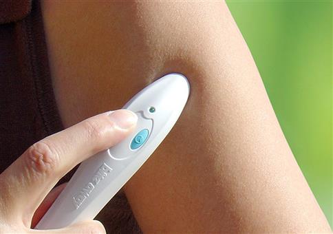 Empfehlung: bite away