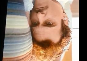 Joaquin Phoenixs Stirn 