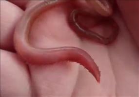Blutwurm zeigt Zähne