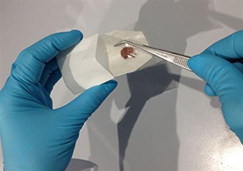 Künstliches Jungfernhäutchen