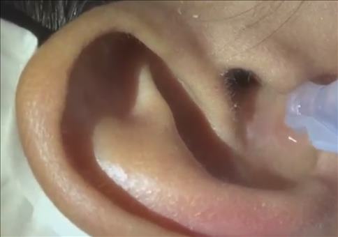 Was krabbelt mich denn da im Ohr?