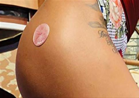 Richtig fürn Arsch!