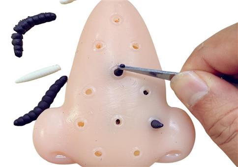 Für die, die gerne mal Pickel ausdrücken