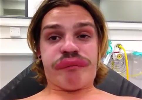 Dicke Lippe riskiert