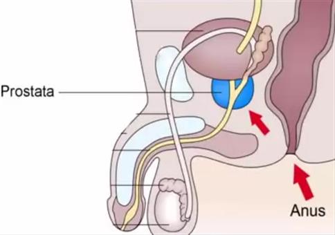 Prostata- und Anusbeschuss stoppen!