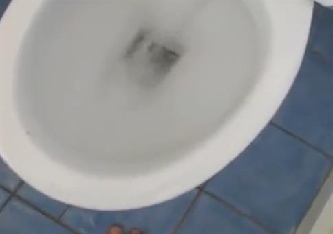 Wenn es dir beim Scheiße auf einmal am Arsch kitzelt