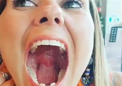 Sich am Zäpfchen lecken