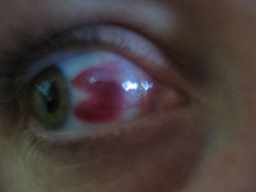 hornoxe.com_picdump134_10