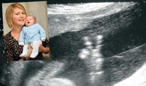 hornoxe.com_picdump216_047