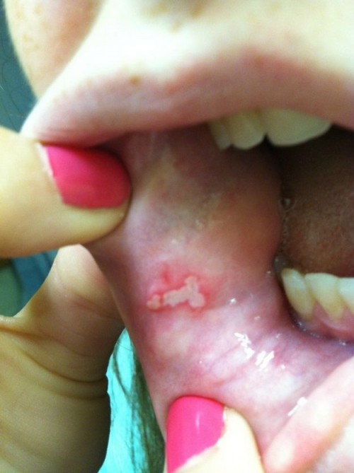 hornoxe.com_picdump275_103